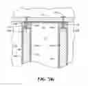 Fig. 19 - TRANSLUMINAL ENDOSCOPIC SURGERY KIT