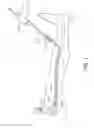 Fig. 02 - Systems and methods for treatment of perforator veins for venous insufficiency