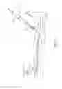 Fig. 03 - Systems and methods for treatment of perforator veins for venous insufficiency