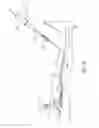Fig. 07 - Systems and methods for treatment of perforator veins for venous insufficiency