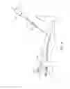 Fig. 09 - Systems and methods for treatment of perforator veins for venous insufficiency