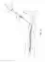 Fig. 12 - Systems and methods for treatment of perforator veins for venous insufficiency