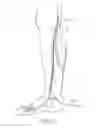 Fig. 14 - Systems and methods for treatment of perforator veins for venous insufficiency