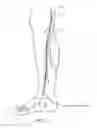 Fig. 16 - Systems and methods for treatment of perforator veins for venous insufficiency