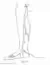 Fig. 18 - Systems and methods for treatment of perforator veins for venous insufficiency