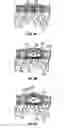 Fig. 07 - Dilation system and method