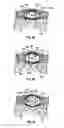 Fig. 08 - Dilation system and method