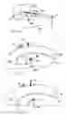 Fig. 14 - System and method for all-inside suture fixation for implant attachment and soft tissue repair