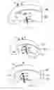 Fig. 15 - System and method for all-inside suture fixation for implant attachment and soft tissue repair