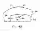 Fig. 17 - System and method for all-inside suture fixation for implant attachment and soft tissue repair