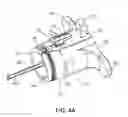 Fig. 05 - Flexible anchor delivery system