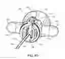 Fig. 08 - Flexible anchor delivery system