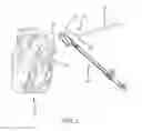 Fig. 05 - Left atrial appendage treatment systems and methods