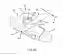 Fig. 09 - Left atrial appendage treatment systems and methods