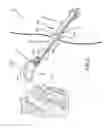 Fig. 16 - Left atrial appendage treatment systems and methods