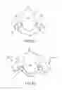Fig. 20 - Left atrial appendage treatment systems and methods