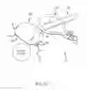 Fig. 30 - Left atrial appendage treatment systems and methods
