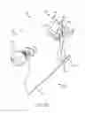 Fig. 34 - Left atrial appendage treatment systems and methods