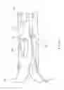 Fig. 05 - Multifunctional Core for Two-Piece Hemostasis Clip