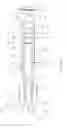 Fig. 19 - Multifunctional Core for Two-Piece Hemostasis Clip