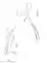 Fig. 02 - Surgical clip applicator and apparatus including the same
