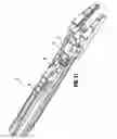 Fig. 16 - Endoscopic surgical clip applier