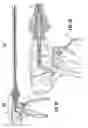 Fig. 22 - Endoscopic surgical clip applier