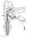 Fig. 28 - Endoscopic surgical clip applier