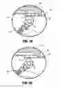 Fig. 29 - Endoscopic surgical clip applier