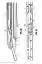 Fig. 34 - Endoscopic surgical clip applier