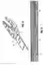 Fig. 40 - Endoscopic surgical clip applier