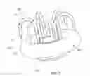 Fig. 11 - VESSEL OCCLUSION DEVICES, KITS AND METHODS