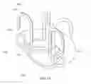 Fig. 16 - VESSEL OCCLUSION DEVICES, KITS AND METHODS