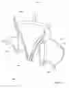 Fig. 20 - VESSEL OCCLUSION DEVICES, KITS AND METHODS