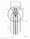 Fig. 23 - VESSEL OCCLUSION DEVICES, KITS AND METHODS