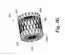 Fig. 29 - ENDOVASCULAR OCCLUSION DEVICE WITH HEMODYNAMICALLY ENHANCED SEALING AND ANCHORING