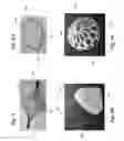 Fig. 35 - ENDOVASCULAR OCCLUSION DEVICE WITH HEMODYNAMICALLY ENHANCED SEALING AND ANCHORING