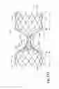 Fig. 40 - ENDOVASCULAR OCCLUSION DEVICE WITH HEMODYNAMICALLY ENHANCED SEALING AND ANCHORING
