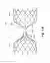 Fig. 41 - ENDOVASCULAR OCCLUSION DEVICE WITH HEMODYNAMICALLY ENHANCED SEALING AND ANCHORING