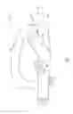 Fig. 04 - Revision joint replacement device and method