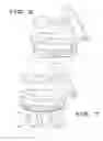 Fig. 05 - Intra-operatively adjustable cutting guide