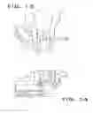 Fig. 09 - Intra-operatively adjustable cutting guide