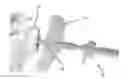 Fig. 01 - Undercutting system for use in conjunction with sacroiliac fusion