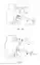 Fig. 05 - Undercutting system for use in conjunction with sacroiliac fusion