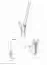 Fig. 05 - INSTRUMENTS AND METHODS FOR SHAPING A BONE CAVITY