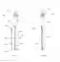 Fig. 10 - INSTRUMENTS AND METHODS FOR SHAPING A BONE CAVITY
