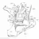 Fig. 01 - SURGICAL GUIDE WITH INTRAOPERATIVE DEPTH FEEDBACK