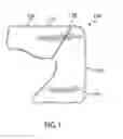 Fig. 02 - Distal femur cutting block and method of using the same
