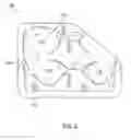 Fig. 03 - Distal femur cutting block and method of using the same