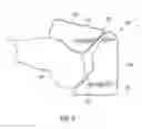 Fig. 07 - Distal femur cutting block and method of using the same